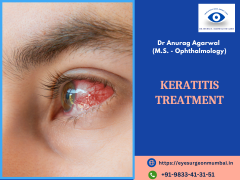 Keratitis Treatment in Mumbai