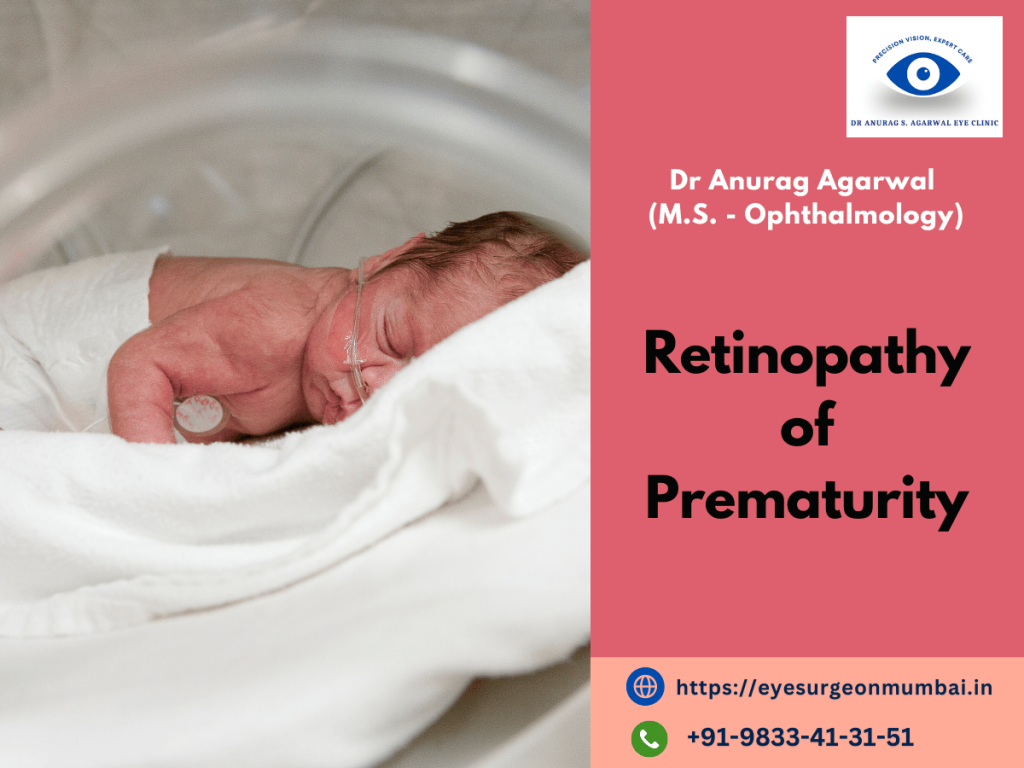 Retinopathy of Prematurity