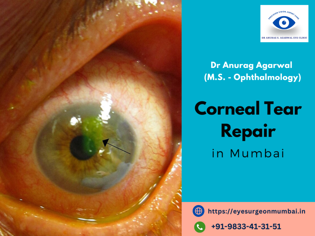 Corneal Tear Repair