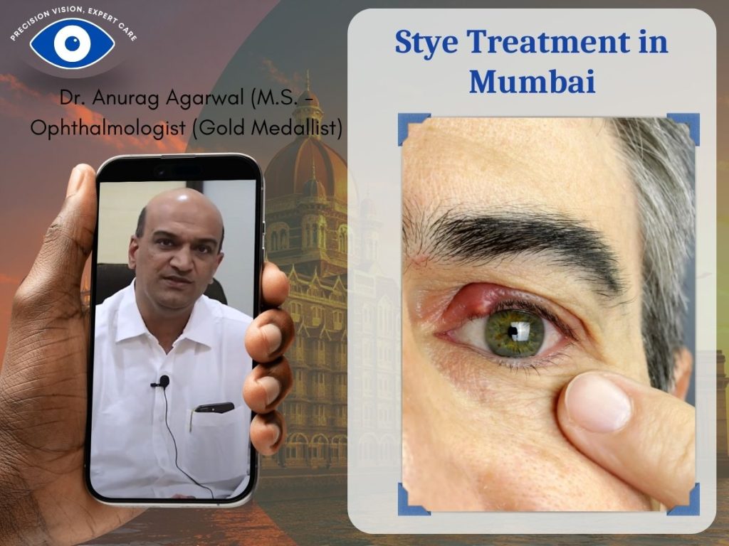 Stye Treatment